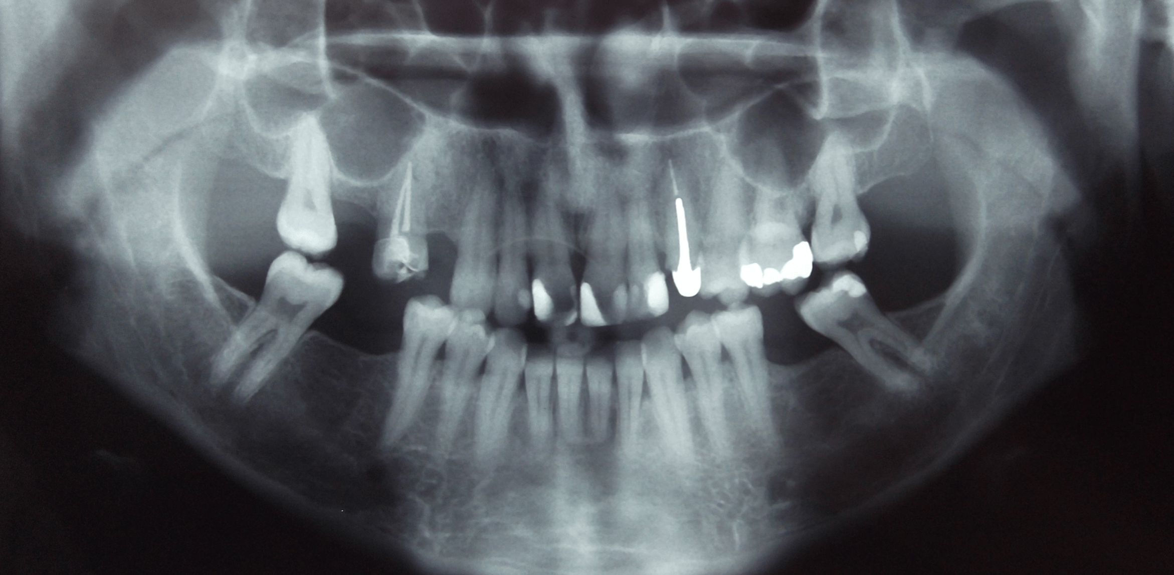 Skygate Dental Radiographs